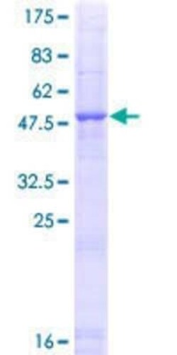 Novus Biologicals Recombinant Human CELA1 GST (N-Term) Protein 25 &mu;g | Buy Online | Novus Biologicals&trade; | Fisher Scientific