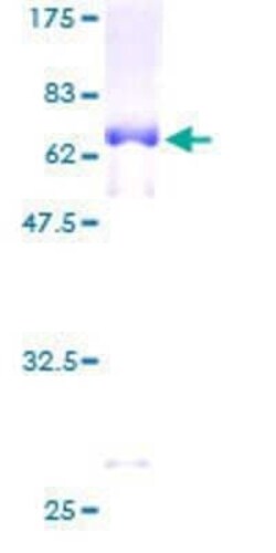 Novus Biologicals Recombinant Human SERPINB1 GST (N-Term) Protein 10 &mu;g | Buy Online | Novus Biologicals&trade; | Fisher Scientific
