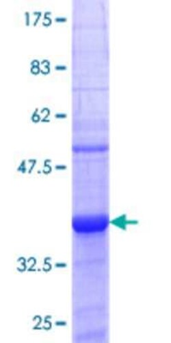 Novus Biologicals Recombinant Human SERPINB1 GST (N-Term) Protein 25 &mu;g | Buy Online | Novus Biologicals&trade; | Fisher Scientific