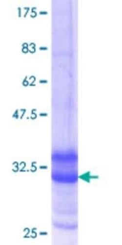 Novus Biologicals Recombinant Human HuC GST (N-Term) Protein 10 &mu;g | Buy Online | Novus Biologicals&trade; | Fisher Scientific