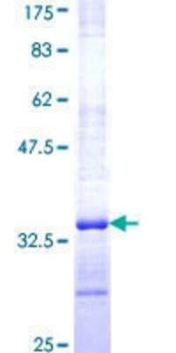 Novus Biologicals Recombinant Human ELAVL4 GST (N-Term) Protein 25 &mu;g | Buy Online | Novus Biologicals&trade; | Fisher Scientific