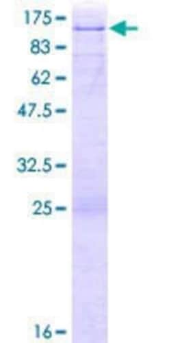 Novus Biologicals Recombinant Human E74 like factor 1 GST (N-Term) Protein 25 &mu;g | Buy Online | Novus Biologicals&trade; | Fisher Scientific