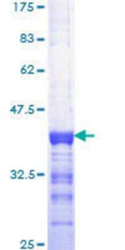 Novus Biologicals Recombinant Human E74 like factor 1 GST (N-Term) Protein 25 &mu;g | Buy Online | Novus Biologicals&trade; | Fisher Scientific