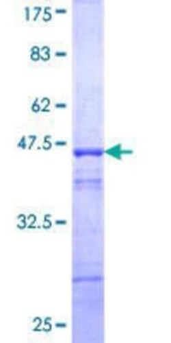 Novus Biologicals Recombinant Human ELF2 GST (N-Term) Protein 10 &mu;g | Buy Online | Novus Biologicals&trade; | Fisher Scientific