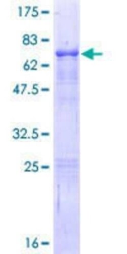 Novus Biologicals Recombinant Human ELF3/ESE-1 GST (N-Term) Protein 25 &mu;g | Buy Online | Novus Biologicals&trade; | Fisher Scientific