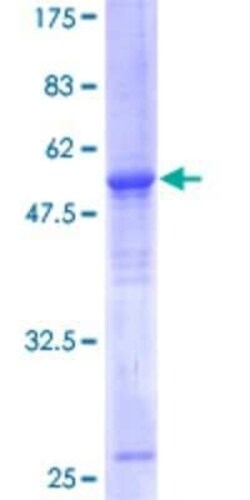 Novus Biologicals Recombinant Human ELF5 GST (N-Term) Protein 2 &mu;g | Buy Online | Novus Biologicals&trade; | Fisher Scientific