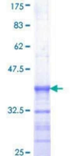 Novus Biologicals Recombinant Human Elk-1 GST (N-Term) Protein 10 &mu;g | Buy Online | Novus Biologicals&trade; | Fisher Scientific
