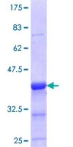 Novus Biologicals Recombinant Human ELK3 GST (N-Term) Protein 10 &mu;g | Buy Online | Novus Biologicals&trade; | Fisher Scientific