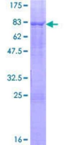 Novus Biologicals Recombinant Human ELK4 GST (N-Term) Protein 2 &mu;g | Buy Online | Novus Biologicals&trade; | Fisher Scientific