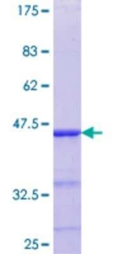 Novus Biologicals Recombinant Human ELK4 GST (N-Term) Protein 25 &mu;g | Buy Online | Novus Biologicals&trade; | Fisher Scientific