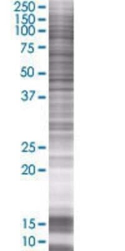 Novus Biologicals Elastin 293T Cell Transient Overexpression Lysate 0.1 mL | Buy Online | Novus Biologicals&trade; | Fisher Scientific