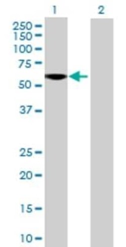 Novus Biologicals Elastin 293T Cell Transient Overexpression Lysate 0.1 mL | Buy Online | Novus Biologicals&trade; | Fisher Scientific