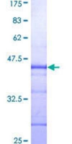 Novus Biologicals Recombinant Human Emerin GST (N-Term) Protein 25 &mu;g | Buy Online | Novus Biologicals&trade; | Fisher Scientific