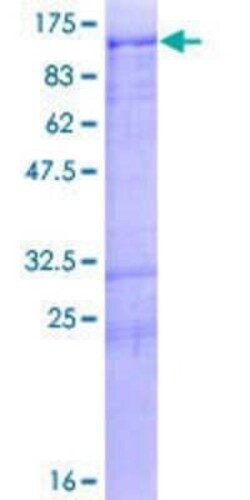 Novus Biologicals Recombinant Human MARK2 GST (N-Term) Protein 2 &mu;g | Buy Online | Novus Biologicals&trade; | Fisher Scientific