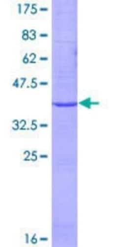 Novus Biologicals Recombinant Human EMP2 GST (N-Term) Protein 10 &mu;g | Buy Online | Novus Biologicals&trade; | Fisher Scientific