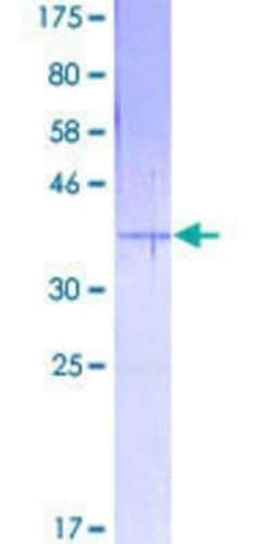Novus Biologicals Recombinant Human EMP3 GST (N-Term) Protein 25 &mu;g | Buy Online | Novus Biologicals&trade; | Fisher Scientific