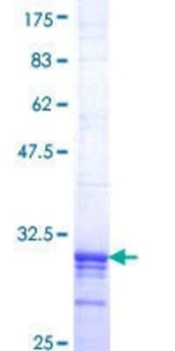 Novus Biologicals Recombinant Human EMP3 GST (N-Term) Protein 25 &mu;g | Buy Online | Novus Biologicals&trade; | Fisher Scientific