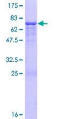 Novus Biologicals Recombinant Human ENO1P GST (N-Term) Protein 10 &mu;g | Buy Online | Novus Biologicals&trade; | Fisher Scientific
