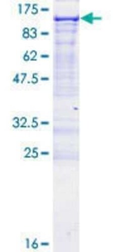 Novus Biologicals Recombinant Human EPB41L1 GST (N-Term) Protein 25 &mu;g | Buy Online | Novus Biologicals&trade; | Fisher Scientific