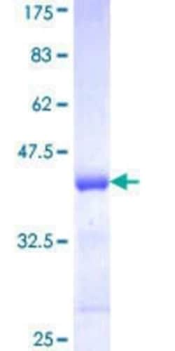 Novus Biologicals Recombinant Human EPB41L1 GST (N-Term) Protein 10 &mu;g | Buy Online | Novus Biologicals&trade; | Fisher Scientific