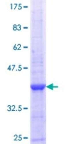 Novus Biologicals Recombinant Human EPB42 GST (N-Term) Protein 25 &mu;g | Buy Online | Novus Biologicals&trade; | Fisher Scientific