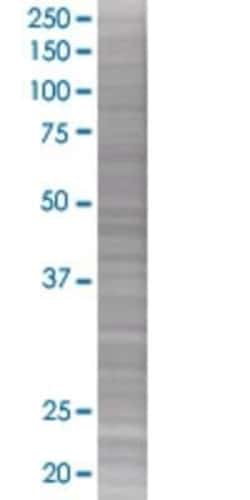 Novus Biologicals Erythropoietin/EPO 293T Cell Transient Overexpression Lysate 0.1 mL | Buy Online | Novus Biologicals&trade; | Fisher Scientific