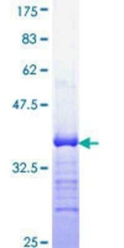 Novus Biologicals Recombinant Human ERG GST (N-Term) Protein 25 &mu;g | Buy Online | Novus Biologicals&trade; | Fisher Scientific