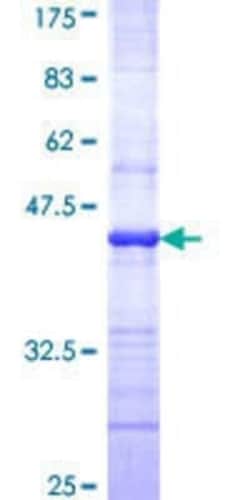 Novus Biologicals Recombinant Human IRE1 alpha GST (N-Term) Protein 25 &mu;g | Buy Online | Novus Biologicals&trade; | Fisher Scientific