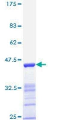 Novus Biologicals Recombinant Human ER beta/NR3A2 GST (N-Term) Protein 10 &mu;g | Buy Online | Novus Biologicals&trade; | Fisher Scientific