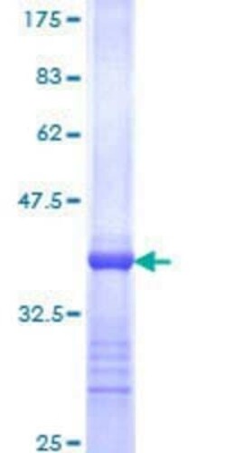 Novus Biologicals Recombinant Human ERR alpha/NR3B1 GST (N-Term) Protein 10 &mu;g | Buy Online | Novus Biologicals&trade; | Fisher Scientific