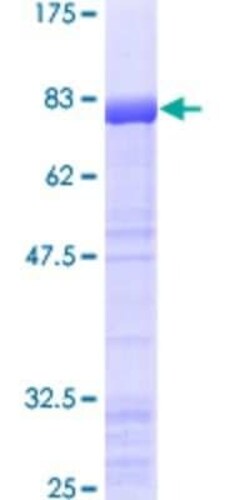 Novus Biologicals Recombinant Human ERR gamma/NR3B3 GST (N-Term) Protein 2 &mu;g | Buy Online | Novus Biologicals&trade; | Fisher Scientific