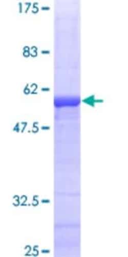 Novus Biologicals&trade;&nbsp;Recombinant Human ETFA GST (N-Term) Protein