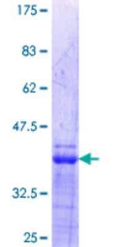Novus Biologicals Recombinant Human Ets-1 GST (N-Term) Protein 10 &mu;g | Buy Online | Novus Biologicals&trade; | Fisher Scientific