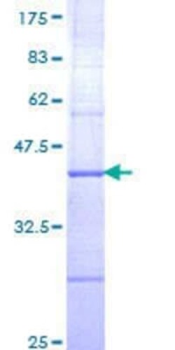 Novus Biologicals Recombinant Human ETV3 GST (N-Term) Protein 25 &mu;g | Buy Online | Novus Biologicals&trade; | Fisher Scientific