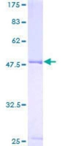 Novus Biologicals Recombinant Human Pea3 GST (N-Term) Protein 10 &mu;g | Buy Online | Novus Biologicals&trade; | Fisher Scientific