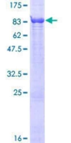 Novus Biologicals Recombinant Human Ellis van Creveld syndrome GST (N-Term) Protein 25 &mu;g | Buy Online | Novus Biologicals&trade; | Fisher Scientific