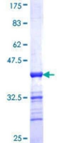 Novus Biologicals Recombinant Human EVI2B GST (N-Term) Protein 25 &mu;g | Buy Online | Novus Biologicals&trade; | Fisher Scientific