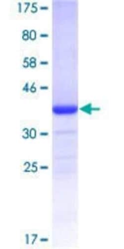 Novus Biologicals Recombinant Human EWSR1 GST (N-Term) Protein 10 &mu;g | Buy Online | Novus Biologicals&trade; | Fisher Scientific