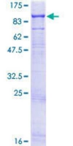 Novus Biologicals Recombinant Human Ext2 GST (N-Term) Protein 2 &mu;g | Buy Online | Novus Biologicals&trade; | Fisher Scientific
