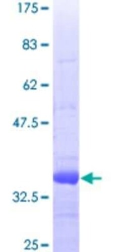 Novus Biologicals Recombinant Human Ext2 GST (N-Term) Protein 25 &mu;g | Buy Online | Novus Biologicals&trade; | Fisher Scientific
