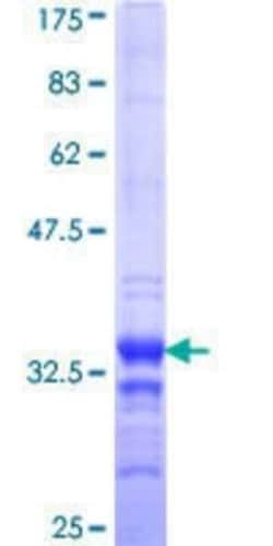 Novus Biologicals Recombinant Human EYA1 GST (N-Term) Protein 25 &mu;g | Buy Online | Novus Biologicals&trade; | Fisher Scientific