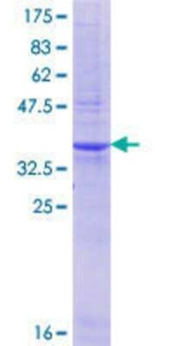Novus Biologicals Recombinant Human EYA3 GST (N-Term) Protein 25 &mu;g | Buy Online | Novus Biologicals&trade; | Fisher Scientific
