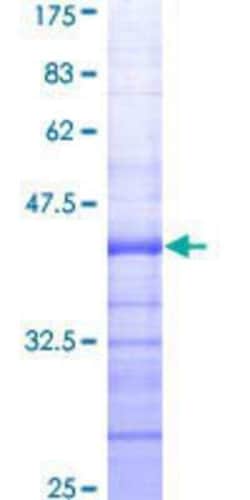 Novus Biologicals Recombinant Human EZH2/KMT6 GST (N-Term) Protein 10 &mu;g | Buy Online | Novus Biologicals&trade; | Fisher Scientific