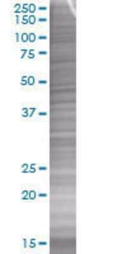 Novus Biologicals Coagulation Factor III/Tissue Factor 293T Cell Transient Overexpression Lysate 0.1 mL | Buy Online | Novus Biologicals&trade; | Fisher Scientific