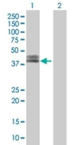 Novus Biologicals Coagulation Factor III/Tissue Factor 293T Cell Transient Overexpression Lysate 0.1 mL | Buy Online | Novus Biologicals&trade; | Fisher Scientific