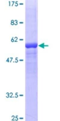 Novus Biologicals Recombinant Human Factor XII heavy chain GST (N-Term) Protein 25 &mu;g | Buy Online | Novus Biologicals&trade; | Fisher Scientific