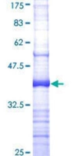 Novus Biologicals Recombinant Human Factor XII heavy chain GST (N-Term) Protein 25 &mu;g | Buy Online | Novus Biologicals&trade; | Fisher Scientific