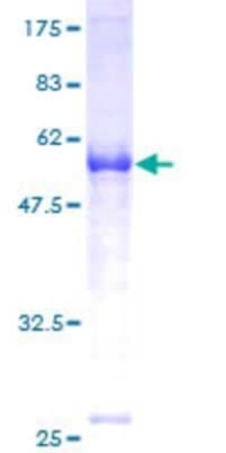 Novus Biologicals Recombinant Human FACA/FANCA GST (N-Term) Protein 25 &mu;g | Buy Online | Novus Biologicals&trade; | Fisher Scientific