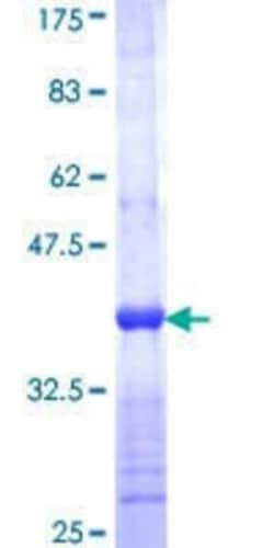 Novus Biologicals Recombinant Human FANCC GST (N-Term) Protein 25 &mu;g | Buy Online | Novus Biologicals&trade; | Fisher Scientific