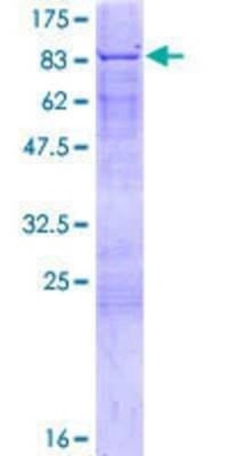 Novus Biologicals Recombinant Human FANCE GST (N-Term) Protein 2 &mu;g | Buy Online | Novus Biologicals&trade; | Fisher Scientific